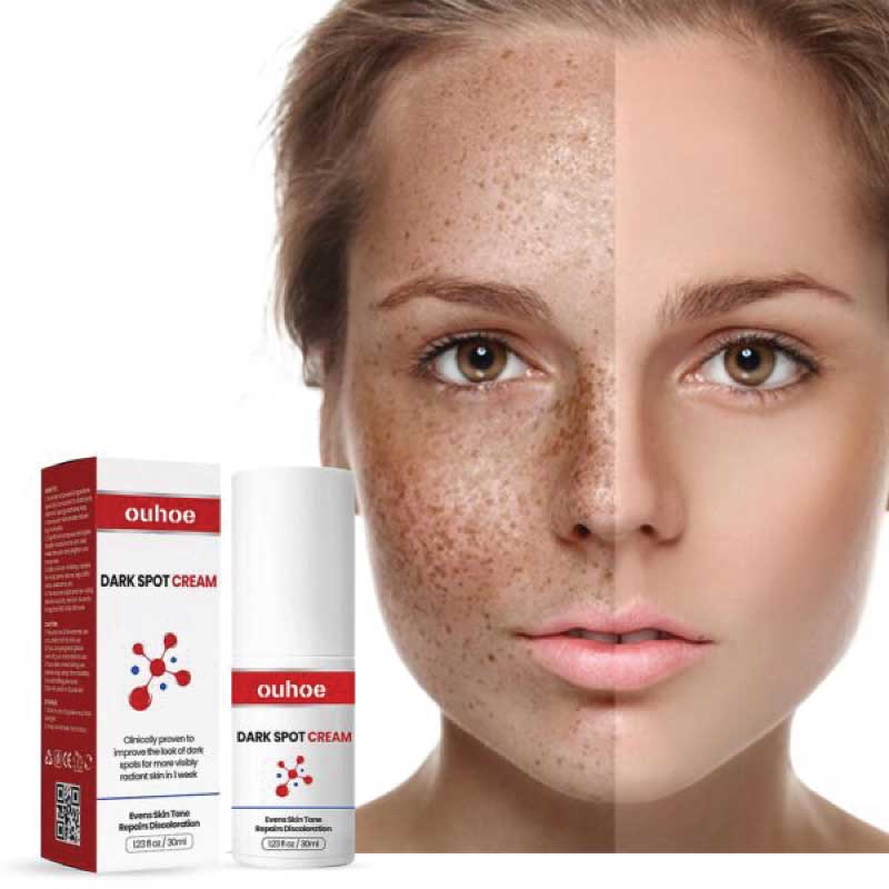 DARK SPOT CREAM